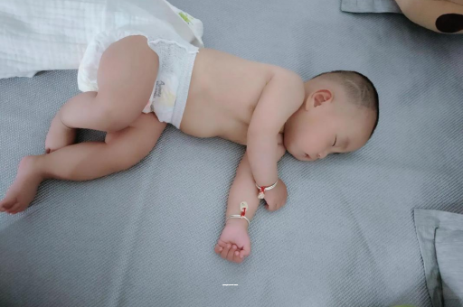嘉善宝宝上火有眼屎